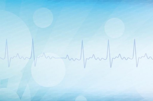 斯柯達明銳黑色是什么黑 14款明銳有幾個顏色